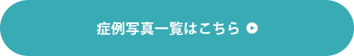 症例写真一覧はこちら