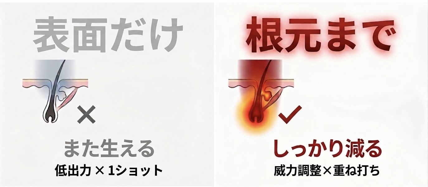 照射の仕組み